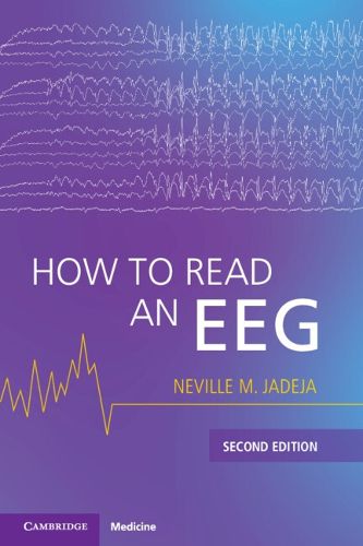 Cover image for How to Read an EEG