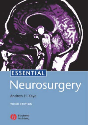 Cover image for Essential Neurosurgery 3e
