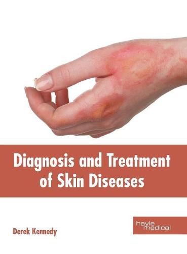 Cover image for Diagnosis and Treatment of Skin Diseases