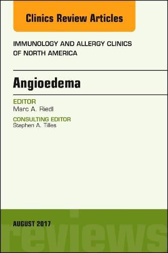 Cover image for Angioedema, An Issue of Immunology and Allergy Clinics of North America