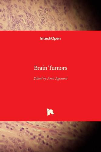 Brain Tumors