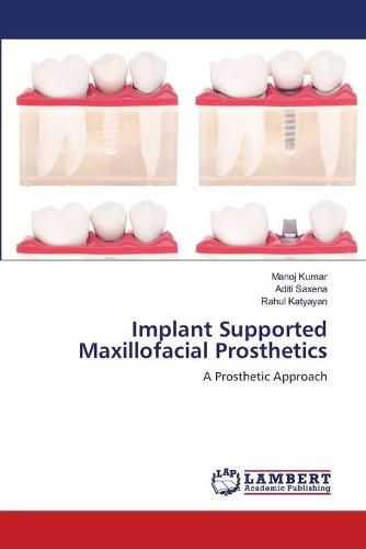 Cover image for Implant Supported Maxillofacial Prosthetics