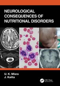 Cover image for Neurological Consequences of Nutritional Disorders