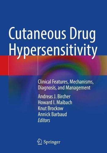 Cover image for Cutaneous Drug Hypersensitivity