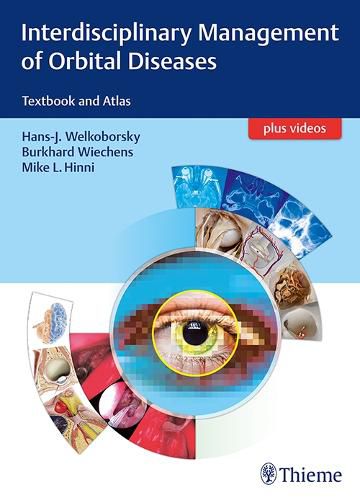 Cover image for Interdisciplinary Management of Orbital Diseases: Textbook and Atlas