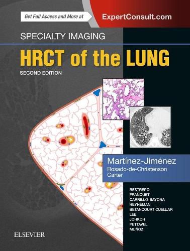 Cover image for Specialty Imaging: HRCT of the Lung