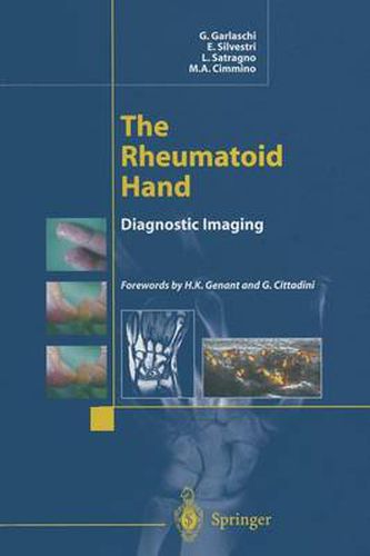 Cover image for The Rheumatoid Hand: Diagnostic Imaging