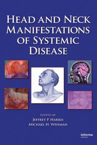 Cover image for Head and Neck Manifestations of Systemic Disease