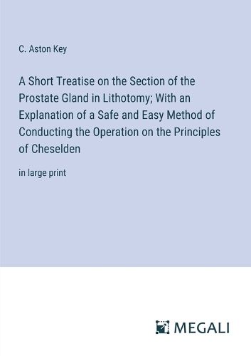 Cover image for A Short Treatise on the Section of the Prostate Gland in Lithotomy; With an Explanation of a Safe and Easy Method of Conducting the Operation on the Principles of Cheselden