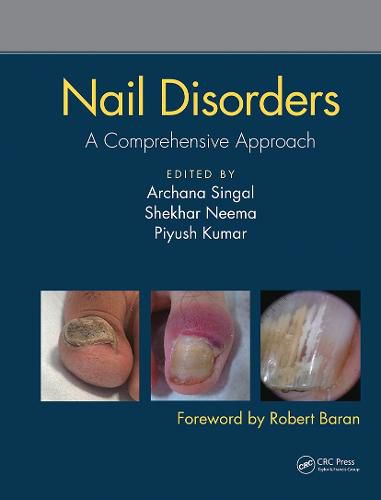 Cover image for Nail Disorders: A Comprehensive Approach