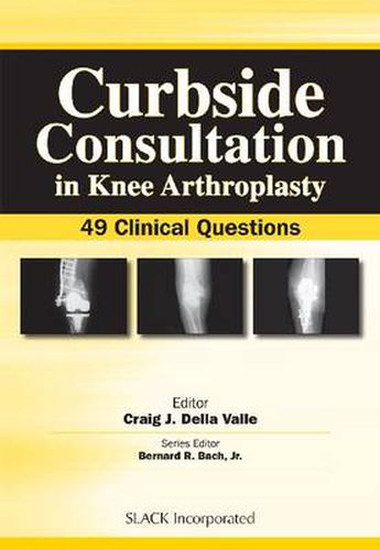 Curbside Consultation in Knee Arthroplasty: 49 Clinical Questions