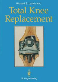 Cover image for Total Knee Replacement