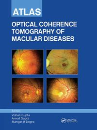 Cover image for Atlas of Optical Coherence Tomography of Macular Diseases