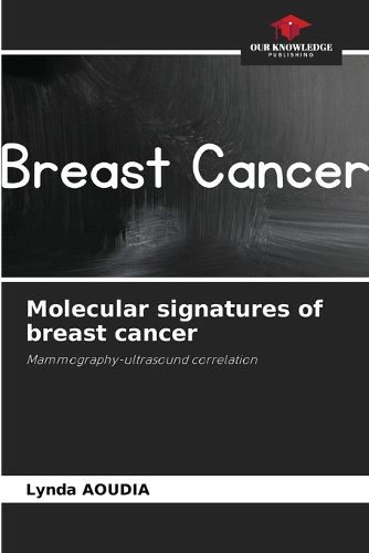 Cover image for Molecular signatures of breast cancer