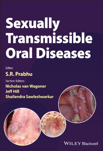 Cover image for Sexually Transmissible Oral Diseases