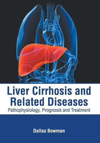 Cover image for Liver Cirrhosis and Related Diseases: Pathophysiology, Prognosis and Treatment