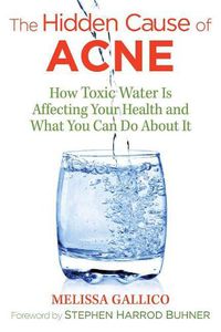 Cover image for The Hidden Cause of Acne: How Toxic Water Is Affecting Your Health and What You Can Do about It