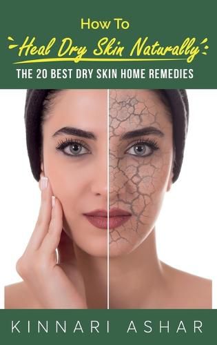 Cover image for How to Heal Dry Skin Naturally