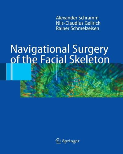 Cover image for Navigational Surgery of the Facial Skeleton