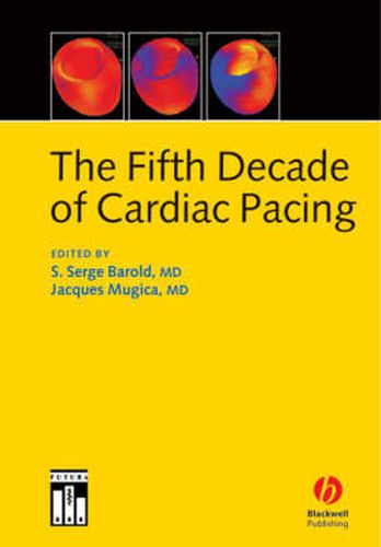 Cover image for The Fifth Decade of Cardiac Pacing