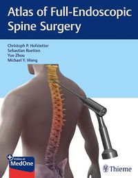 Cover image for Atlas of Full-Endoscopic Spine Surgery