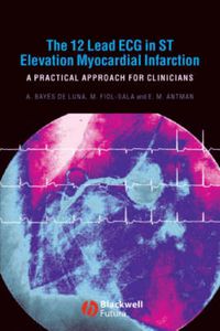 Cover image for The 12 Lead ECG in ST Elevation Myocardial Infarction: A Practical Approach for Clinicians