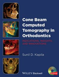 Cover image for Cone Beam Computed Tomography in Orthodontics - Indications, Insights, and Innovations