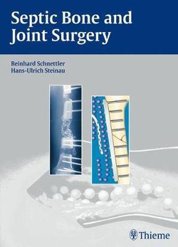 Cover image for Septic Bone and Joint Surgery