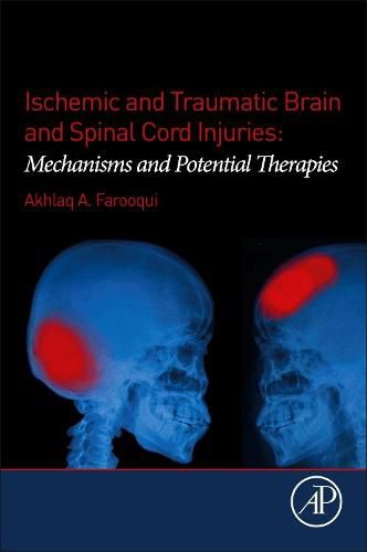 Cover image for Ischemic and Traumatic Brain and Spinal Cord Injuries: Mechanisms and Potential Therapies