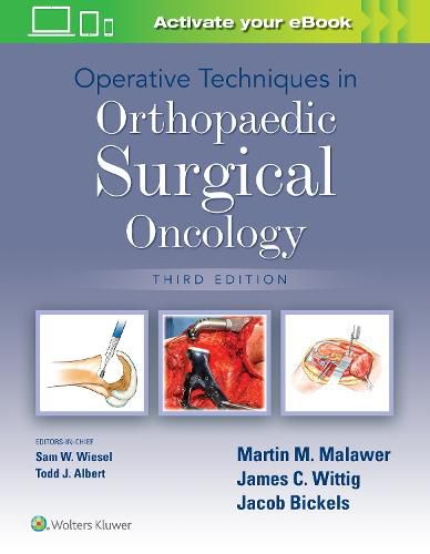 Cover image for Operative Techniques in Orthopaedic Surgical Oncology
