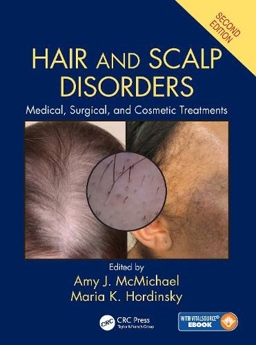 Cover image for Hair and Scalp Disorders: Medical, Surgical, and Cosmetic Treatments, Second Edition