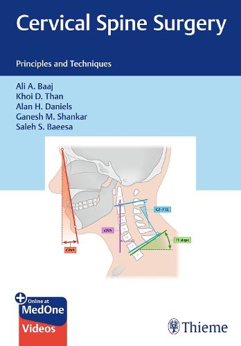 Cover image for Cervical Spine Surgery