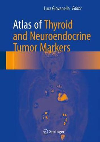 Cover image for Atlas of Thyroid and Neuroendocrine Tumor Markers