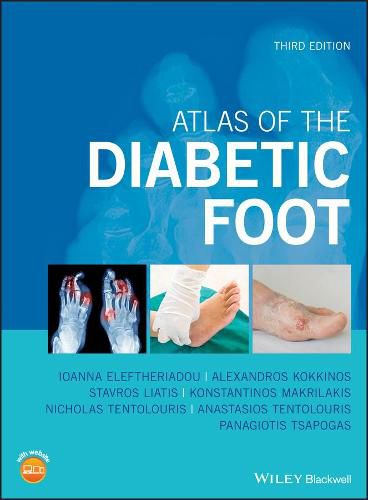 Cover image for Atlas of the Diabetic Foot, 3rd edition