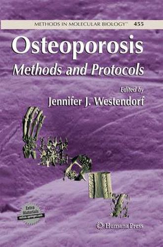 Cover image for Osteoporosis: Methods and Protocols