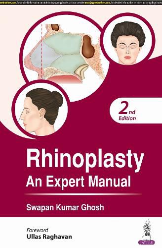 Cover image for Rhinoplasty