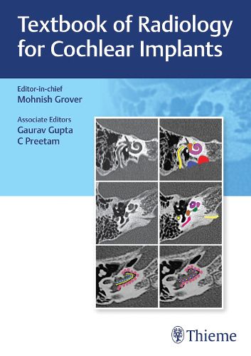 Cover image for Textbook of Radiology for Cochlear Implants