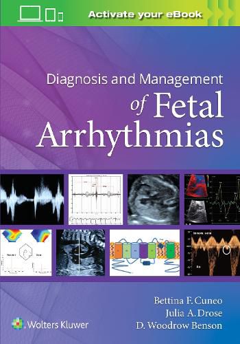 Cover image for Diagnosis and Management of Fetal Arrhythmias