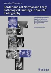 Cover image for Freyschmidt's  Koehler/Zimmer  Borderlands of Normal and Early Pathological Findings in Skeletal Radiography