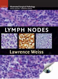 Cover image for Lymph Nodes