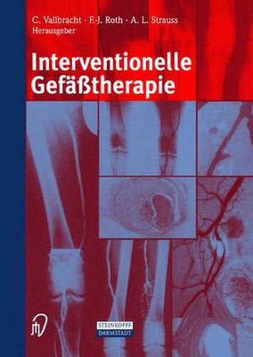 Cover image for Interventionelle Gefasstherapie