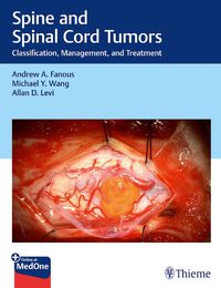 Cover image for Spine and Spinal Cord Tumors