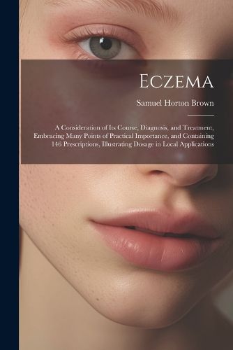 Eczema