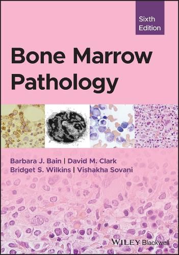 Bone Marrow Pathology