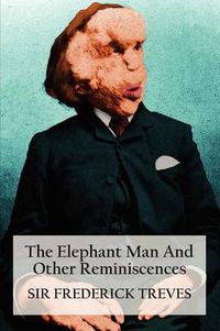 Cover image for The Elephant Man And Other Reminiscences