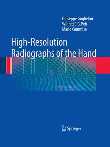 Cover image for High-Resolution Radiographs of the Hand