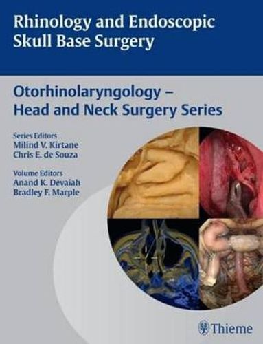 Cover image for Rhinology and Endoscopic Skull Base Surgery