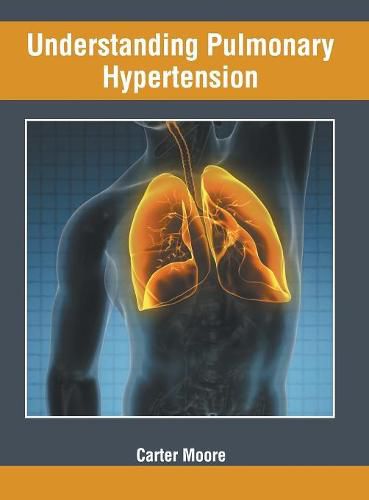 Cover image for Understanding Pulmonary Hypertension