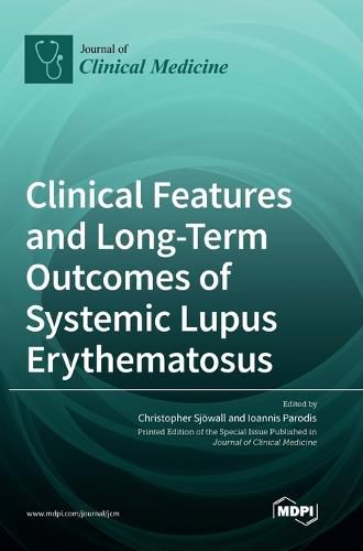 Cover image for Clinical Features and Long-Term Outcomes of Systemic Lupus Erythematosus