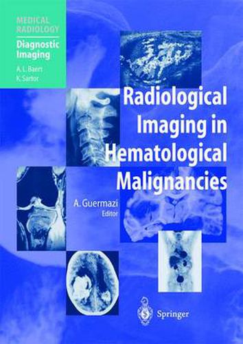 Cover image for Radiological Imaging in Hematological Malignancies